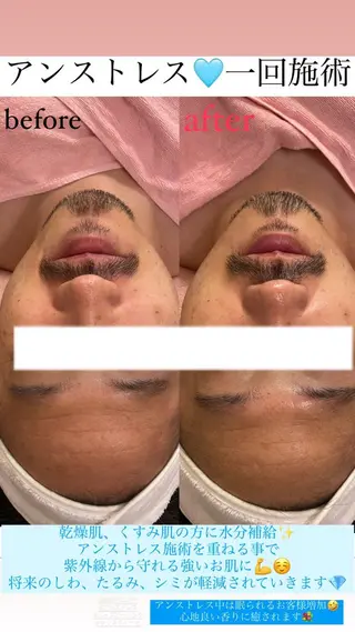 メンズ Salon de Lino 御器所のエステ・リラクイメージ