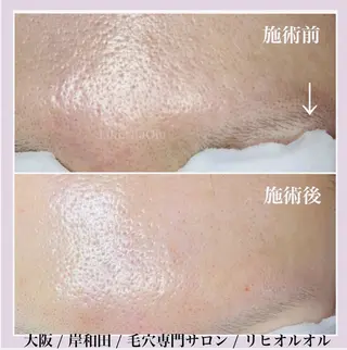 毛穴汚れ改善専門店/ 岸和田/リヒオルオルのエステ・リラクイメージ