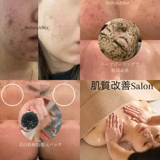 Ginza Charerのエステ・リラクイメージ