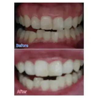 M渋谷店所属・M渋谷 ホワイトニングのエステ・リラクイメージ