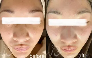 Lavi&所属・肌質改善サロン Lavi&のその他イメージ