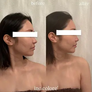エステサロンino.colore'所属・小顔サロン ino.coloreのエステ・リラクイメージ