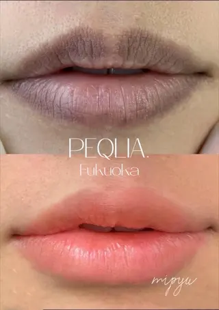 【フェムケア専門店】 PEQLIA福岡のエステ・リラクイメージ