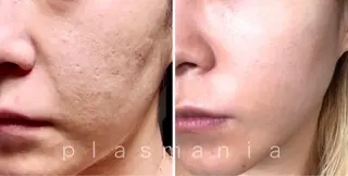 痩身・フェイシャル/if  byOrabriller所属・if byOrab riller【ｲﾌ】のその他イメージ