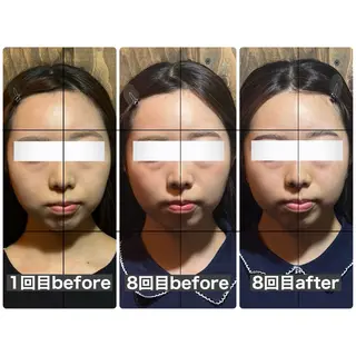 💎後悔させない小顔 矯正💎イトヤマ🌱のエステ・リラクイメージ