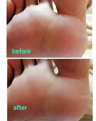 巻き爪&フットケア レクーラのその他イメージ