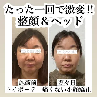 柳瀬 絵美のマツエク・マツパデザイン