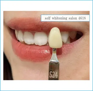 self whitening salon 4618所属・ホワイトニングサロン 4618のその他イメージ