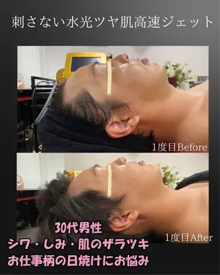 BLOSSOM 菊地のエステ・リラクイメージ