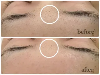 デ・アイム新潟北所属・サイトウ .のエステ・リラクイメージ