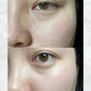 愛維美水光美肌専門店所属・愛維美水光美肌専門店 メンズレディースokのエステ・リラクイメージ