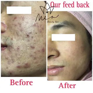 Mia beauty所属・MiA Beautyのエステ・リラクイメージ