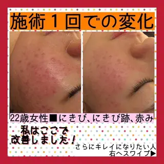 ミディアム カラー パーマ ヘアアレンジ メンズ キッズ ネイル マツエク・マツパ ニキビ・肌質改善専門 ♡人生が変わるサロンのエステ・リラクイメージ