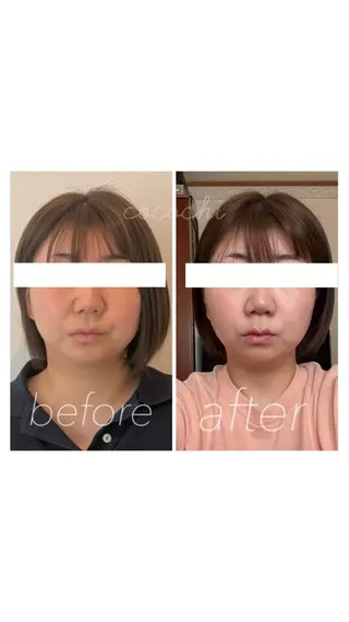 小顔と ヘッドスパのお店のエステ・リラクイメージ