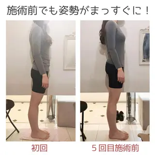 小顔モニター 募集のエステ・リラクイメージ