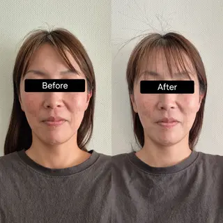 小顔矯正 LNのエステ・リラクイメージ