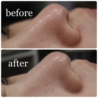 ANRIRE (アンリール)のエステ・リラクイメージ