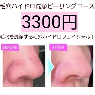 メンズ 小顔・美肌ケア専門 Diva北浜のエステ・リラクイメージ