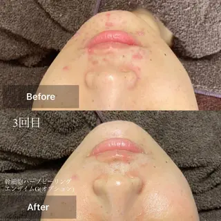 メンズ キッズ 美肌・リラクゼーションサロンLu,Mie所属・美肌と癒しのサロン Lu,Mieのエステ・リラクイメージ