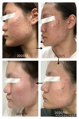 ROR所属・ROR nailのエステ・リラクイメージ