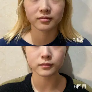 EARTH Coiffure beaute'新潟中野山所属・小池 怜香のエステ・リラクイメージ