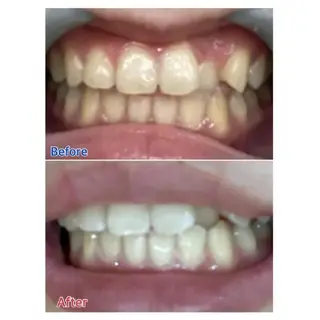 M渋谷店所属・M渋谷 ホワイトニングのエステ・リラクイメージ