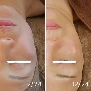 鍼灸サロンmiyabi所属・美容鍼×エステ 鍼灸 サロンmiyabiのエステ・リラクイメージ