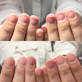 ネイル 自爪育成・巻き爪 補正講師　津蔵のネイルデザイン