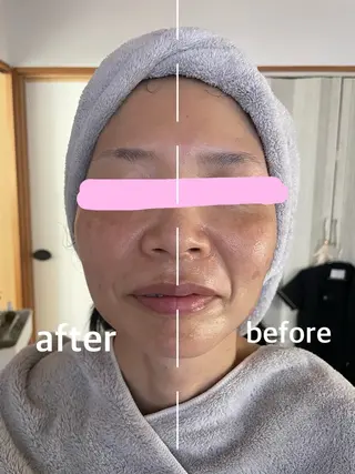 プライベートサロン noaのエステ・リラクイメージ