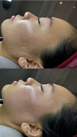 Harry•ハリー🩵韓国コルギとヘアラインのお店所属・韓国肌管理HARRY ・ハリー🤍大村のエステ・リラクイメージ