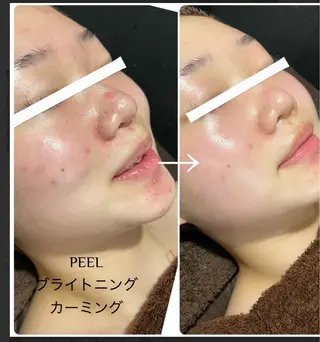 Total Beauty salon Bloom所属・肌育WISHpro 専門サロンBloomのエステ・リラクイメージ