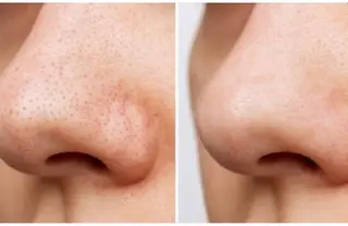 NONOKEKE ノノケケのエステ・リラクイメージ