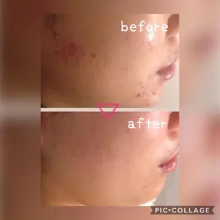 美肌蘇生カウンセラー 横山りえのエステ・リラクイメージ