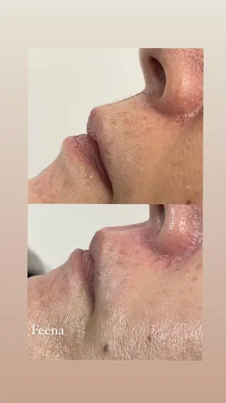 amu nail. RINAのネイルデザイン