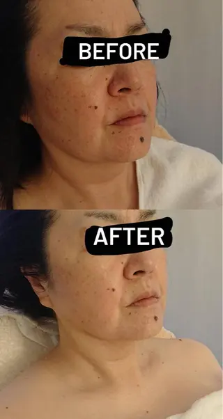 美と癒しのお店OTOHA 2nd所属・OTOHA よしだのエステ・リラクイメージ