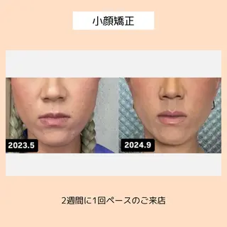 【three】毛穴/ 肌改善/小顔/耳ツボのエステ・リラクイメージ