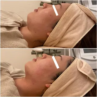 ララ/ハーブ メゾンリュバンのエステ・リラクイメージ