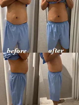 メンズ 腸活サポート みなみののエステ・リラクイメージ