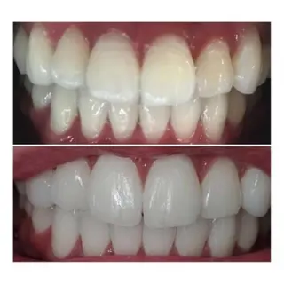 M渋谷店所属・M渋谷 ホワイトニングのエステ・リラクイメージ