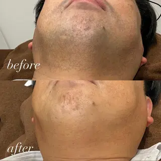 メンズ Attra ほのかの眉毛・アイブロウイメージ