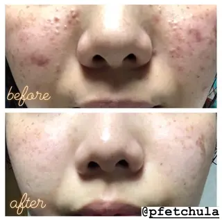 KOHAKU.所属・Nana Kikutaのエステ・リラクイメージ