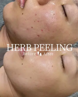 小顔矯正&リンパ専門店EMIER(エミエル)所属・福井二の宮EMIER /ゆきのエステ・リラクイメージ