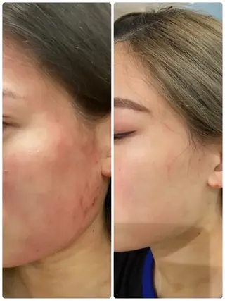 マツエク・マツパ ANABEL+所属・せと ななほ🫧のエステ・リラクイメージ