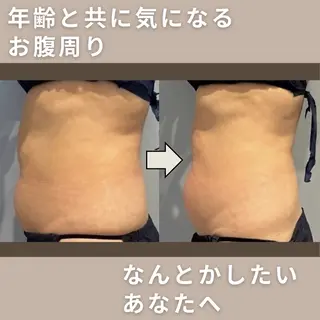 美容室BAUM所属・脂肪コントロール まさえのその他イメージ