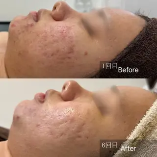 Nicore所属・Nicore NATSUKIのエステ・リラクイメージ