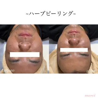 salon merci和泉のエステ・リラクイメージ