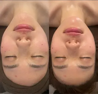 oyam オヤムのエステ・リラクイメージ