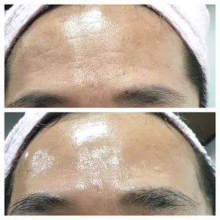 小顔専門看護師クリニカルサロンCOCO所属・小顔と美肌サロン クリニカルサロンココのエステ・リラクイメージ