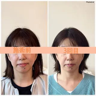小顔矯正サロン　ReFace Fusae（リフェイスフサエ）所属・小顔矯正サロン リフェイスフサエのエステ・リラクイメージ