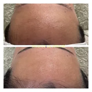 ビューティー ミロワールのエステ・リラクイメージ